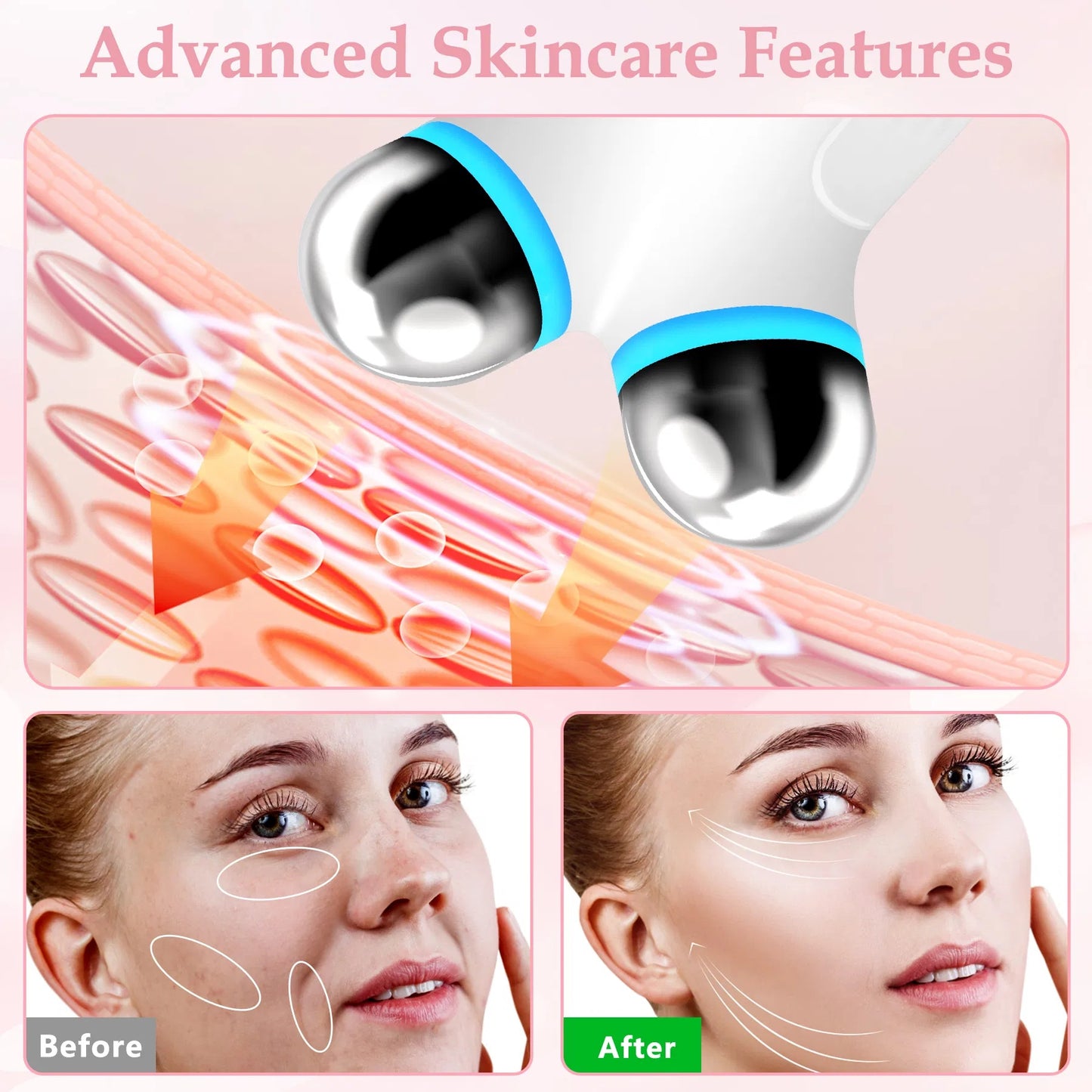 Anti Aging And Wrinkles Facial Device