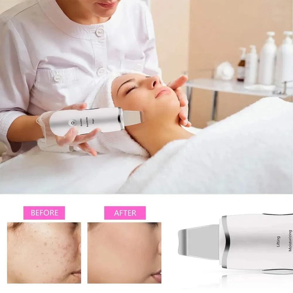 3-in-1 Electric Ultrasonic Skin Scrubber