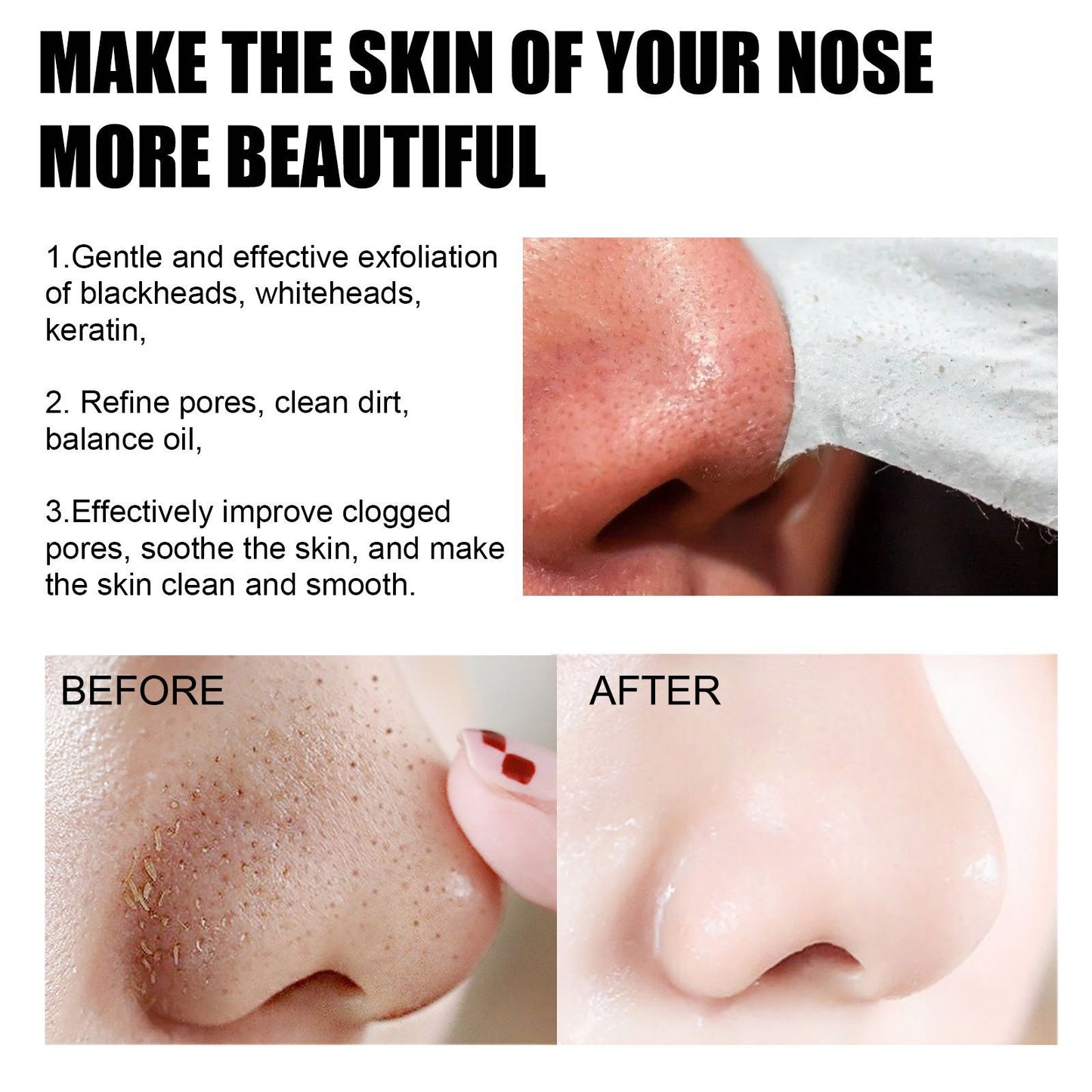 EELHOE Blackhead Removal Nasal Mask