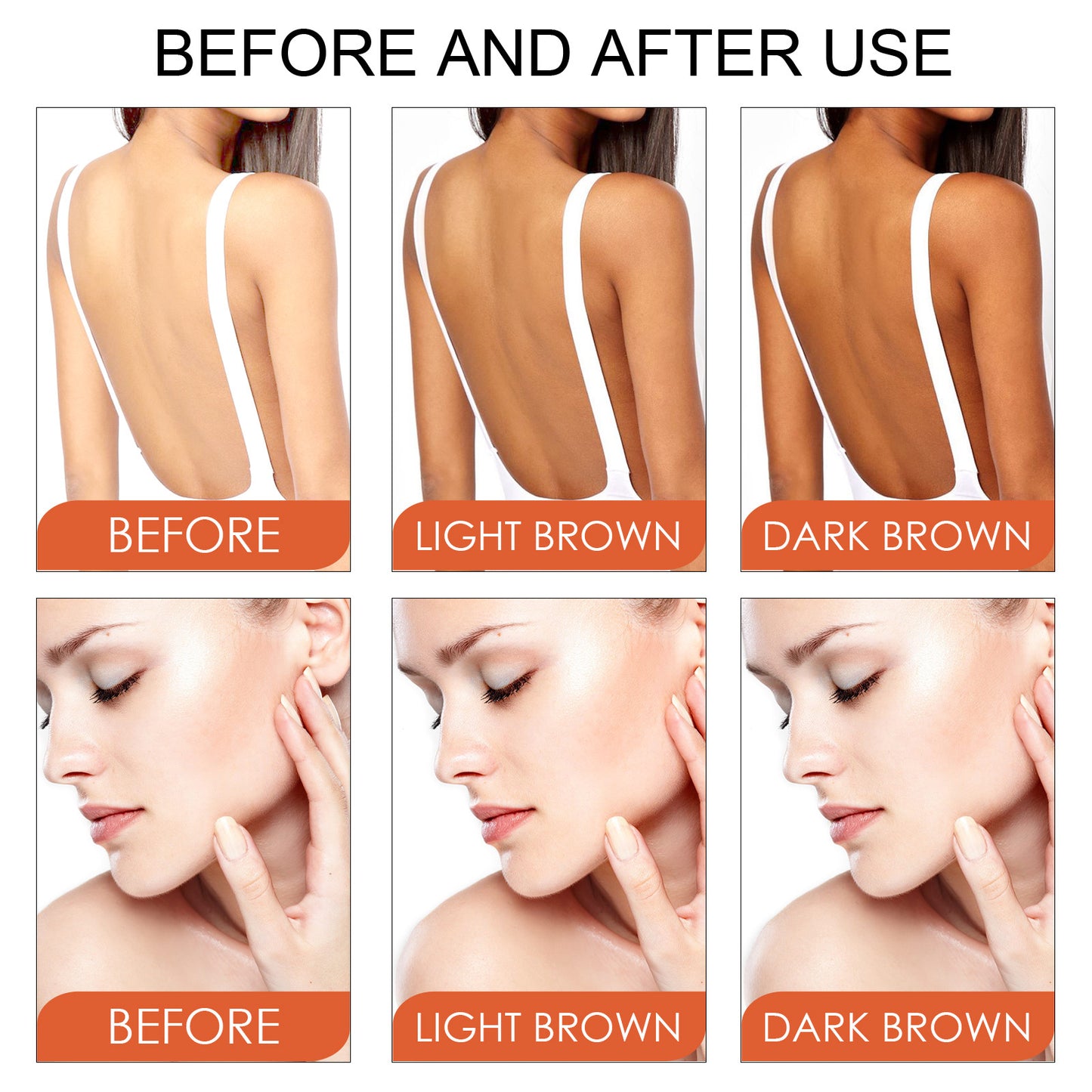 Sunburn Repair Gel