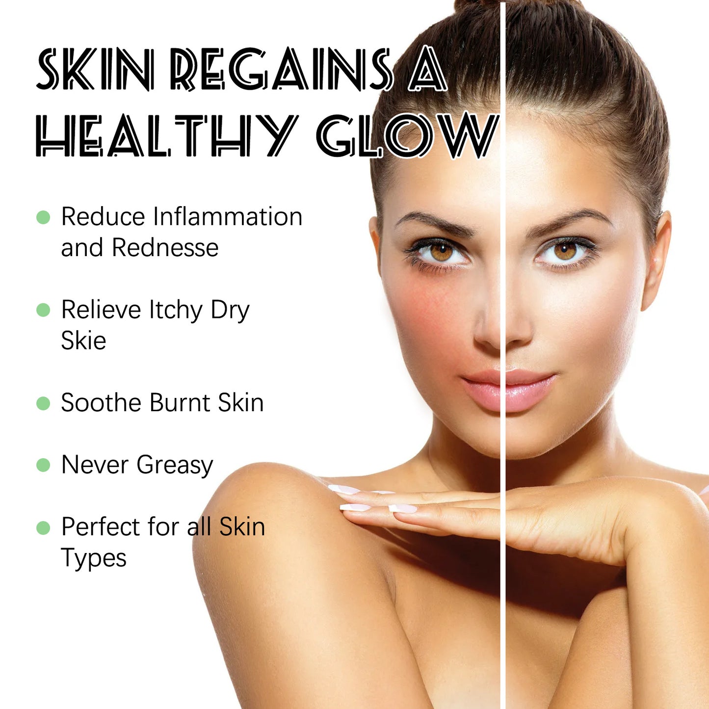 Sunburn Repair Gel