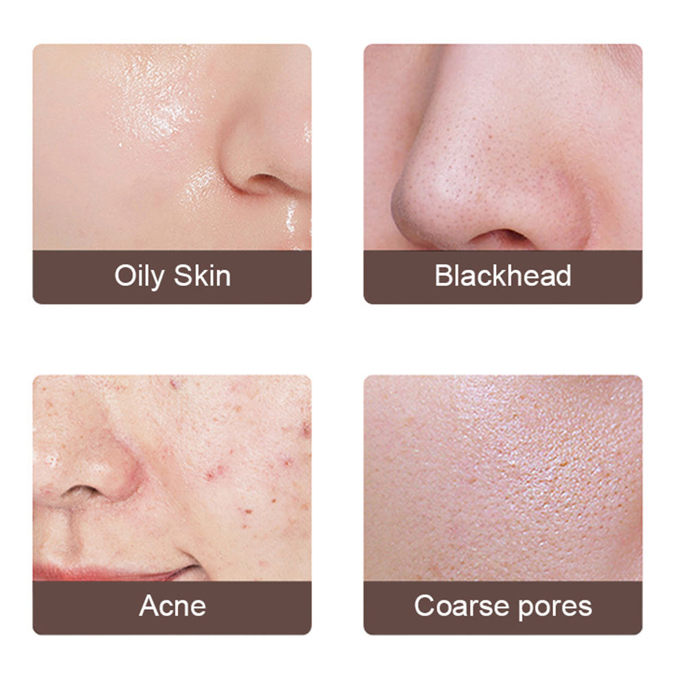 Electric Ultrasonic Skin Scrubber